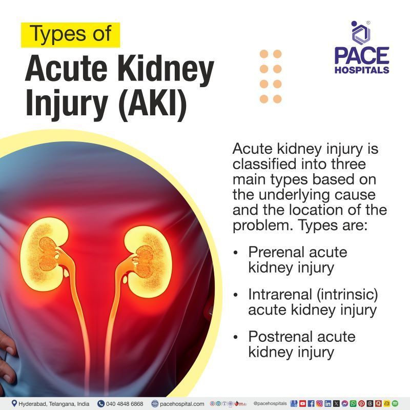 Types of acute kidney injury | Types of AKI | AKI types