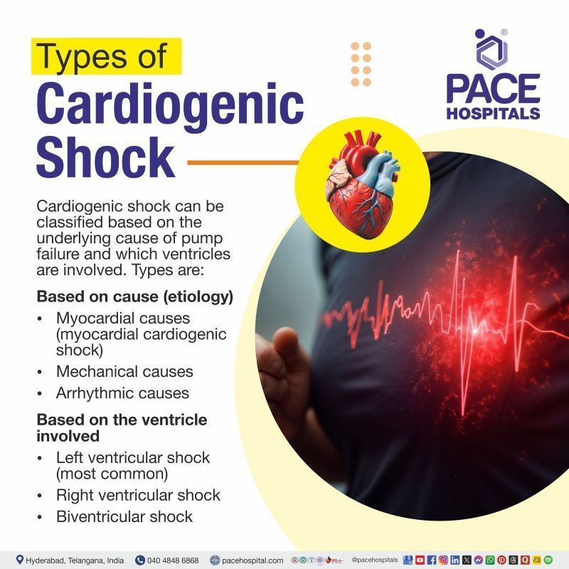 Types of Cardiogenic Shock Types of Cardiogenic Shock | Type of Cardiogenic Shock | Cardiogenic Shock Types