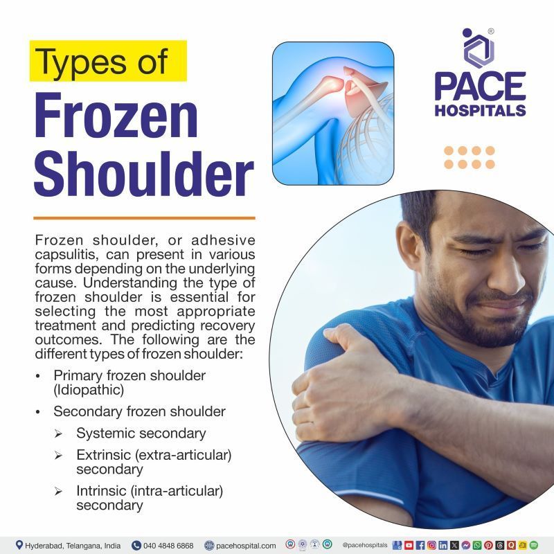 Types of Frozen Shoulder | Frozen Shoulder Type