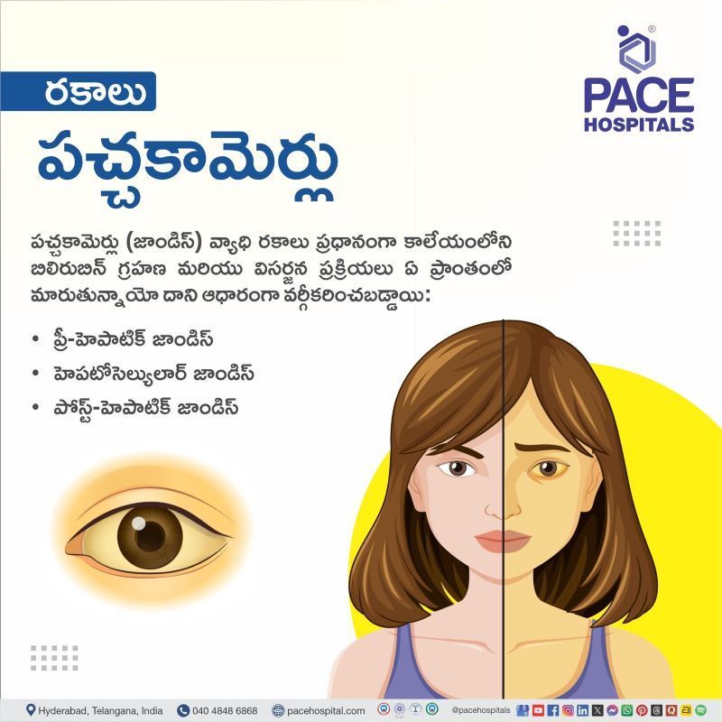 పచ్చకామెర్లు రకాలు | Types of Jaundice in Telugu Jaundice Types in Telugu | పచ్చకామెర్లు రకాలు | Types of Jaundice in Telugu