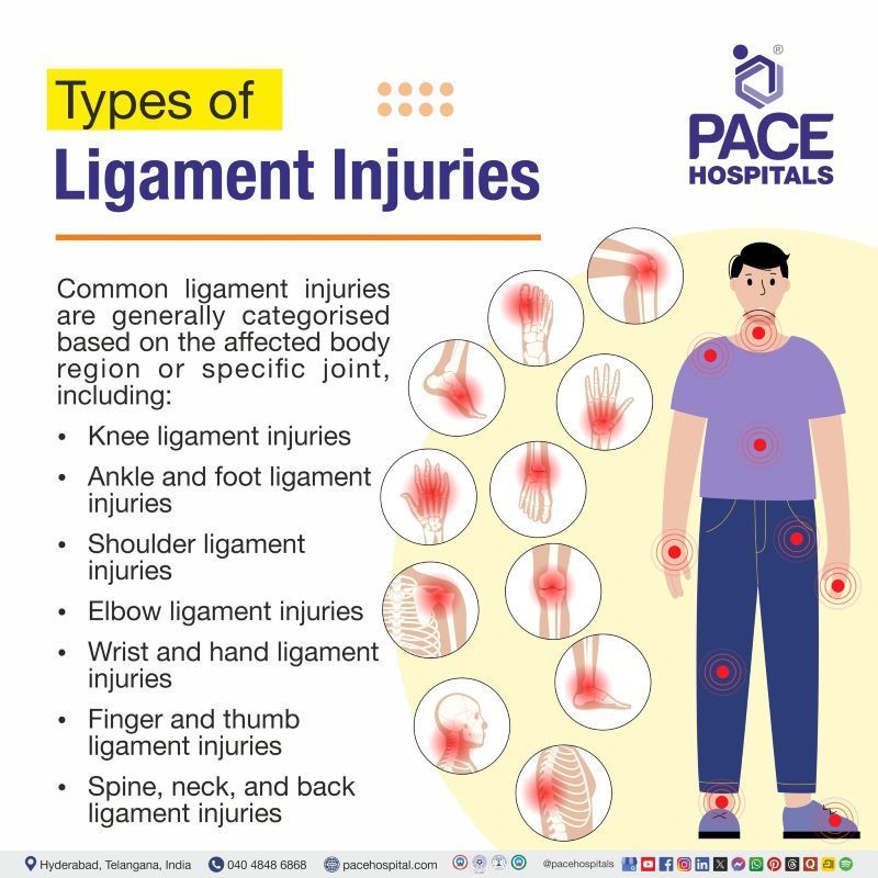 Types of Ligament Injuries Types of Ligament Injuries | Ligament injury type
