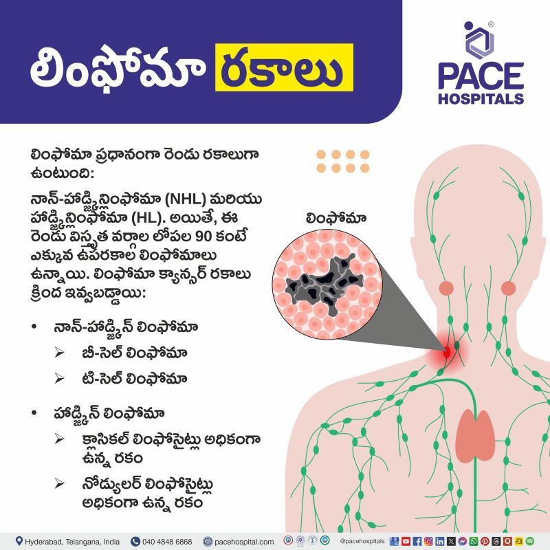 లింఫోమా రకాలు | Types of Lymphoma in Telugu Types of Lymphoma in Telugu | లింఫోమా రకాలు | Lymphoma types in Telugu | Types of lymphoma cancer in Telugu
