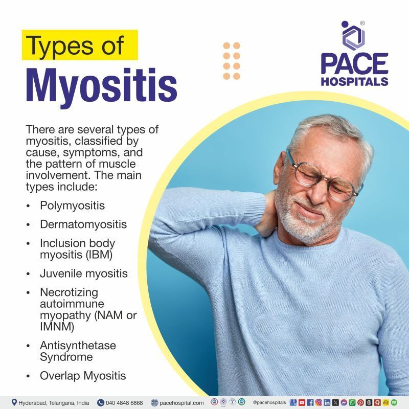 Types of Myositis Types of Myositis | Myositis types | What is the most common type of myositis | Different types of myositis