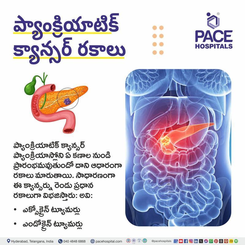 Types of Pancreatic Cancer in Telugu | ప్యాంక్రియాటిక్ క్యాన్సర్ రకాలు | Different types of pancreatic cancer in Telugu