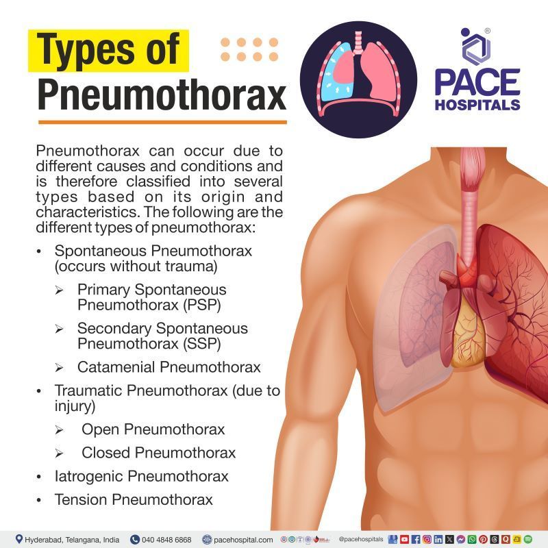 Types of Pneumothorax | Different types of pneumothorax​ | Pneumothorax​ types