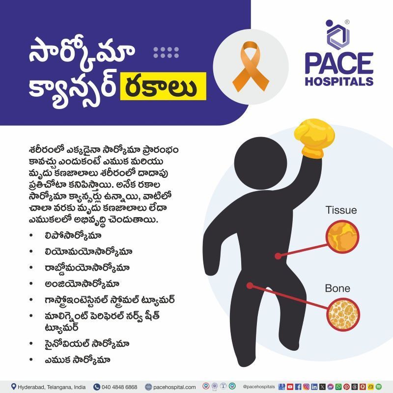 సార్కోమా క్యాన్సర్ రకాలు | Types of Sarcoma Cancer in Telugu Types of Sarcoma in Telugu | సార్కోమా క్యాన్సర్ రకాలు | Sarcoma Type in Telugu