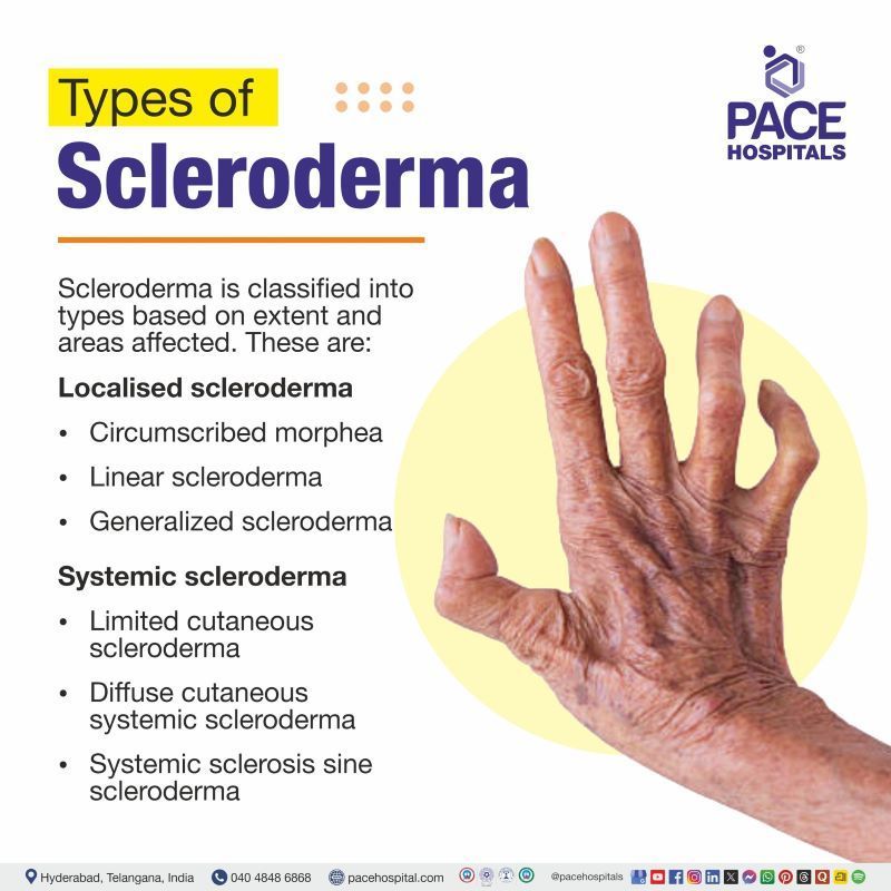 Types of Scleroderma Types of Scleroderma | Different types of scleroderma | Type of scleroderma