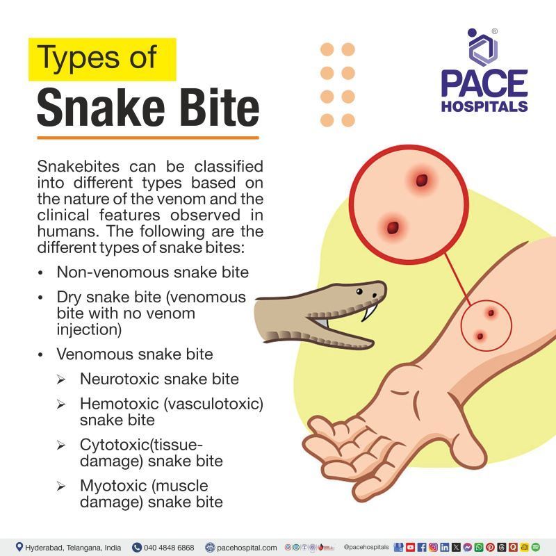 Types of Snake Bite | Different types of snake bite | Snake bites types