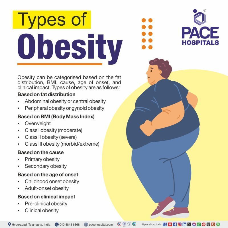 Types of Obesity Types of Obesity | Obesity Types