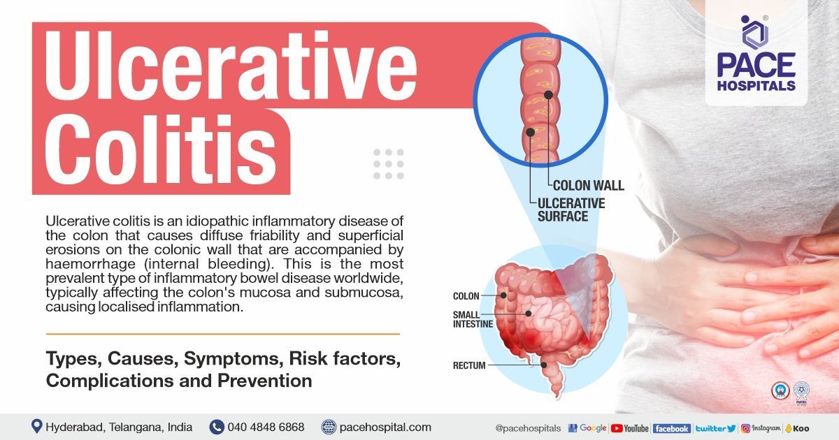 Ulcerative Colitis – Symptoms, Causes, Types, Complications, Risk Factors & Prevention