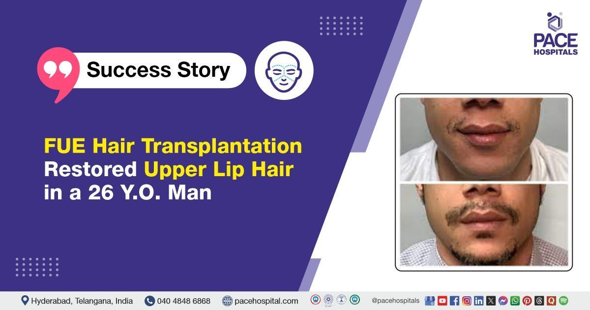 Case study of a 26-year-old male with upper lip scar alopecia treated at PACE Hospitals, Hyderabad