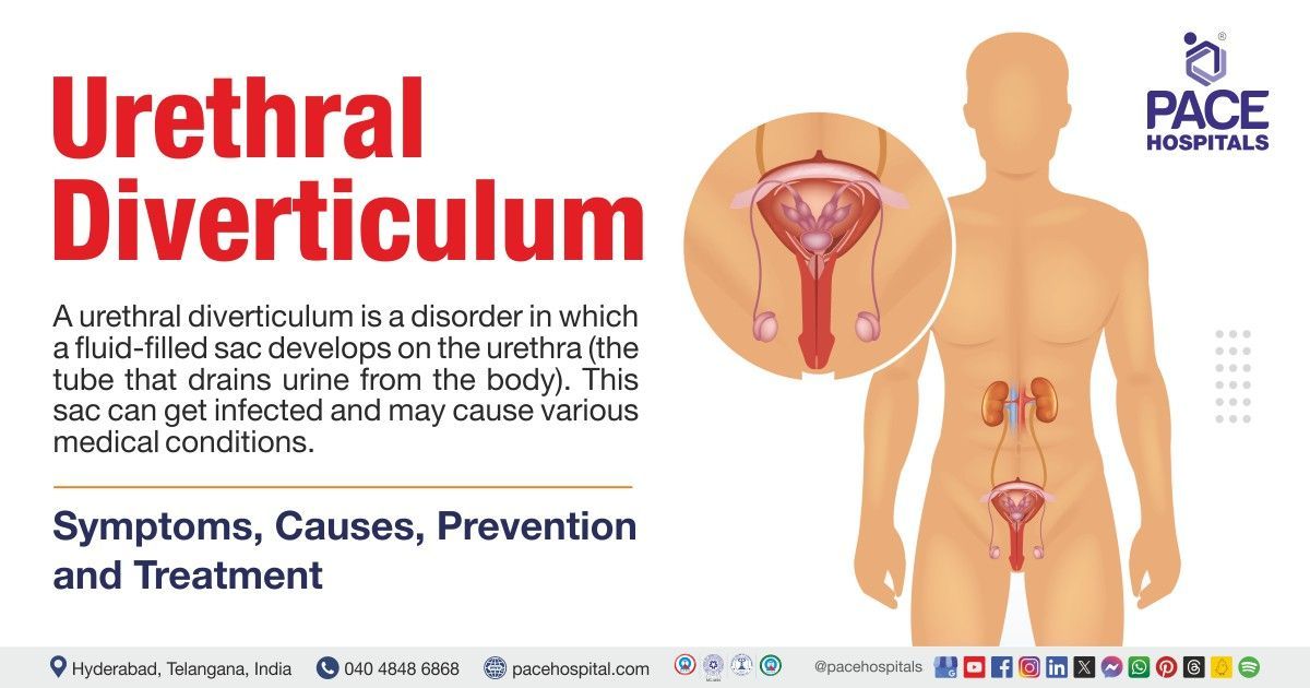 Urethral diverticulum symptoms and causes | Urethral diverticulum treatment in India 