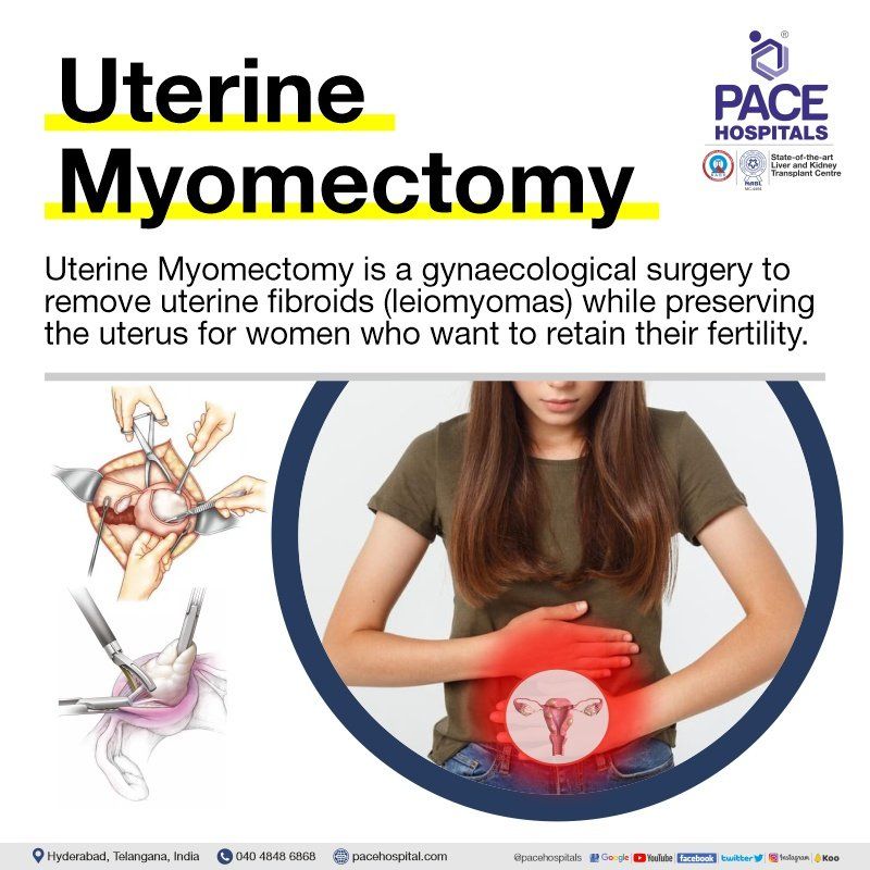 Uterine Myomectomy surgery | Myomectomy Procedure | Myomectomy surgery in Hyderabad | Myomectomy Surgery Cost