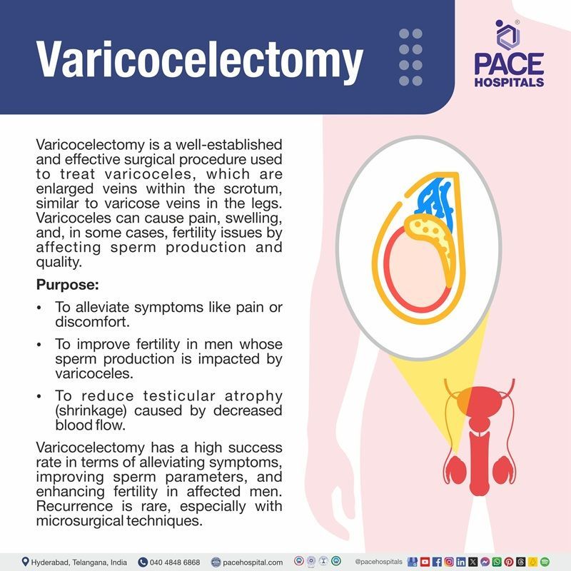 Varicocelectomy definition | varicocelectomy surgery cost in Hyderabad | best hospital for varicocelectomy surgery in Hyderabad | surgery for varicoceles in Hyderabad, India