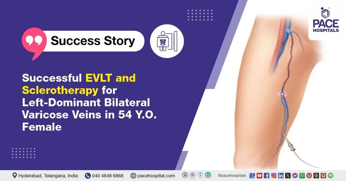 Case study of a 54-year-old woman with varicose veins treated successfully at PACE Hospitals