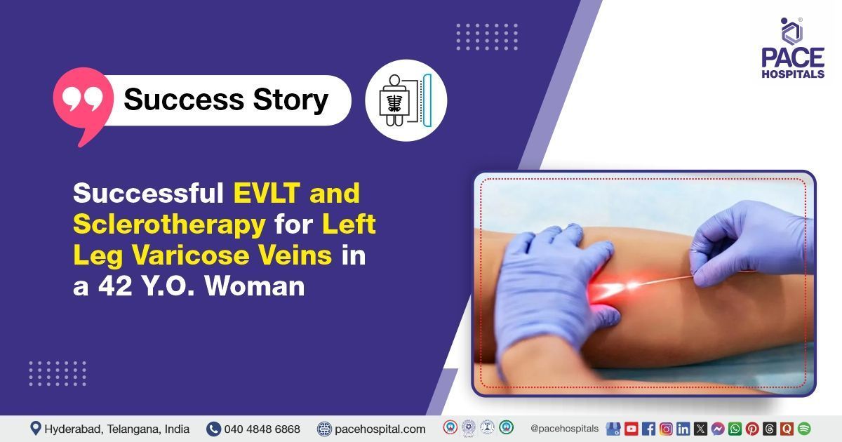 Case study of a 42-year-old woman with left leg varicose veins treated in Hyderabad, India