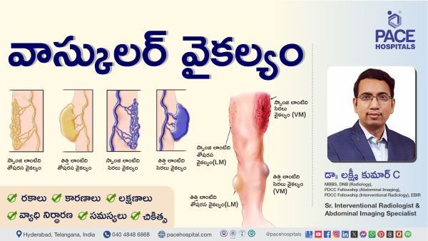 Vascular Malformations Symptoms & Treatment Explained by Dr. Lakshmi Kumar C from PACE Hospitals