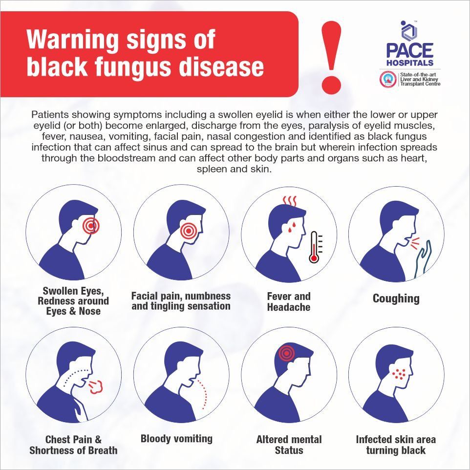 Mucormycosis: Black fungus disease symptoms and warning signs - Pace Hospitals