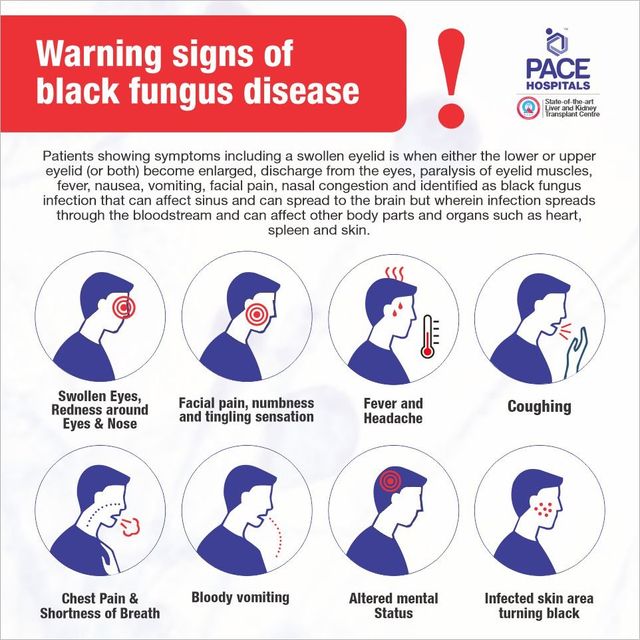 Symptoms black fungus Black Mold