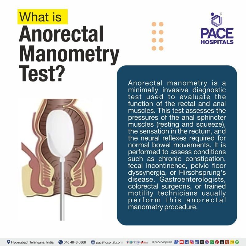 What is Anorectal Manometry Test? | anorectal manometry procedure | Anal Manometry