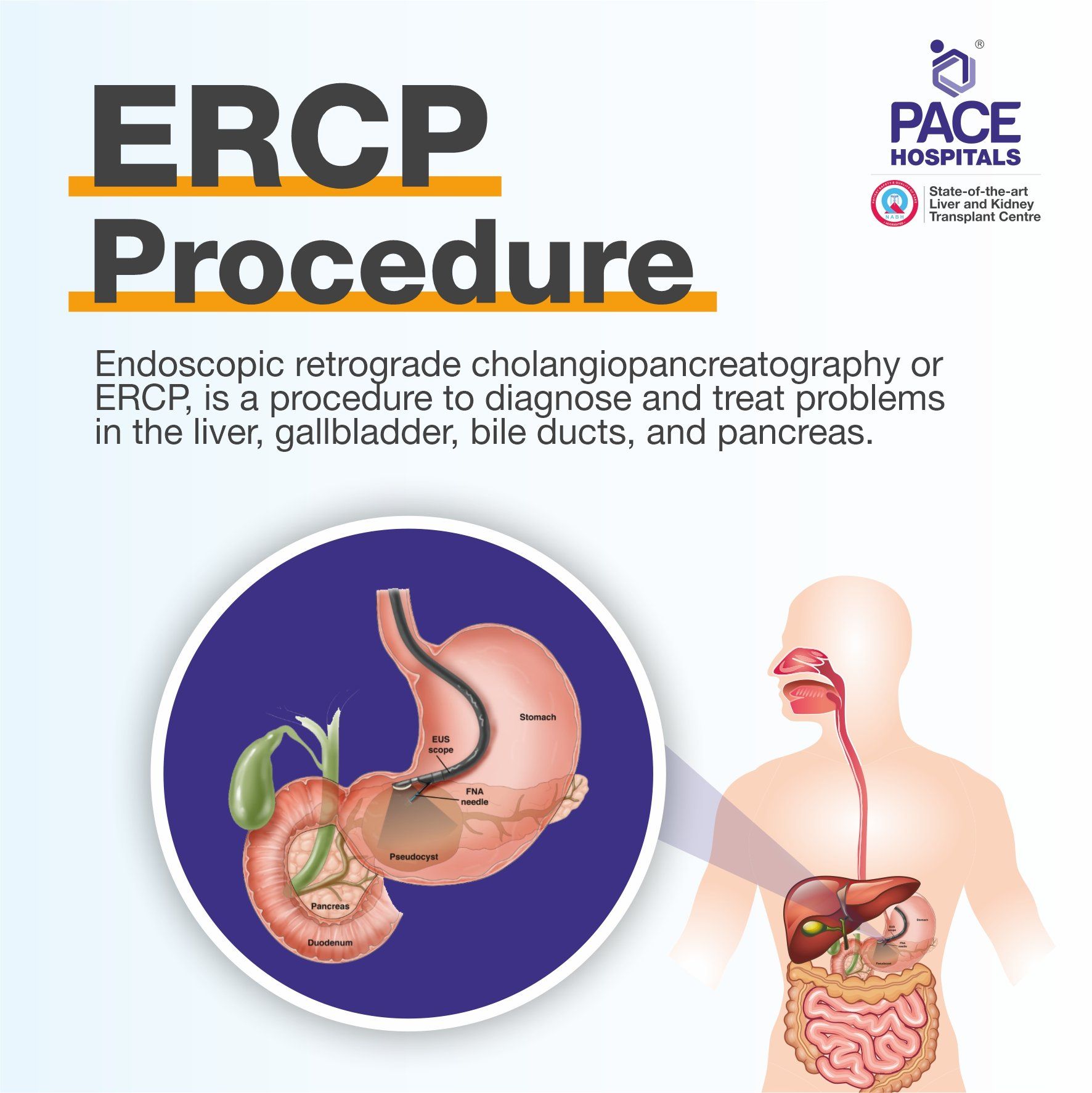 ERCP test, ERCP full form in medical
