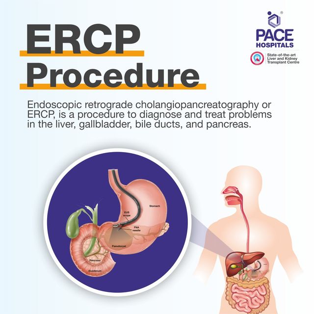 Ercp procedure