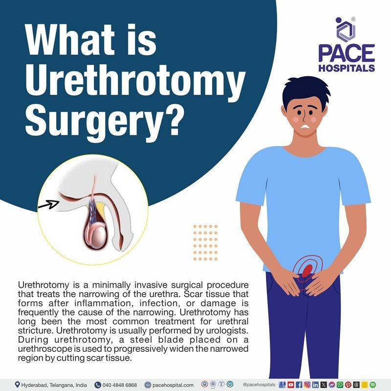 urethrotomy meaning | meaning of urethrotomy | urethrotomy definition | urethrotomy procedure | optical urethrotomy cost in Hyderabad, India