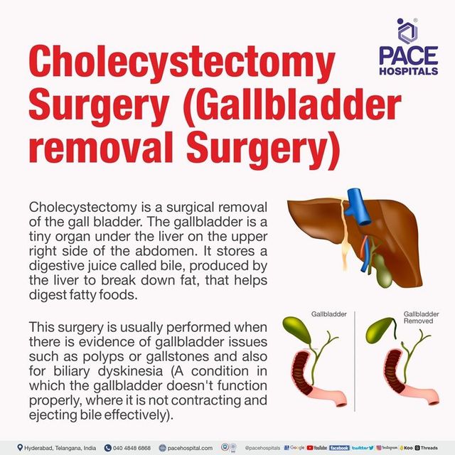 Surgery (Radical Cholecystectomy) For Gallbladder Cancer, 42% OFF