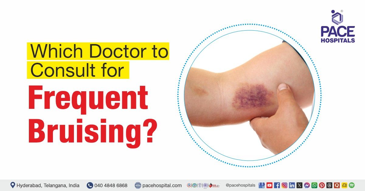 Which doctor should I consult for frequent bruising | doctor for frequent bruising