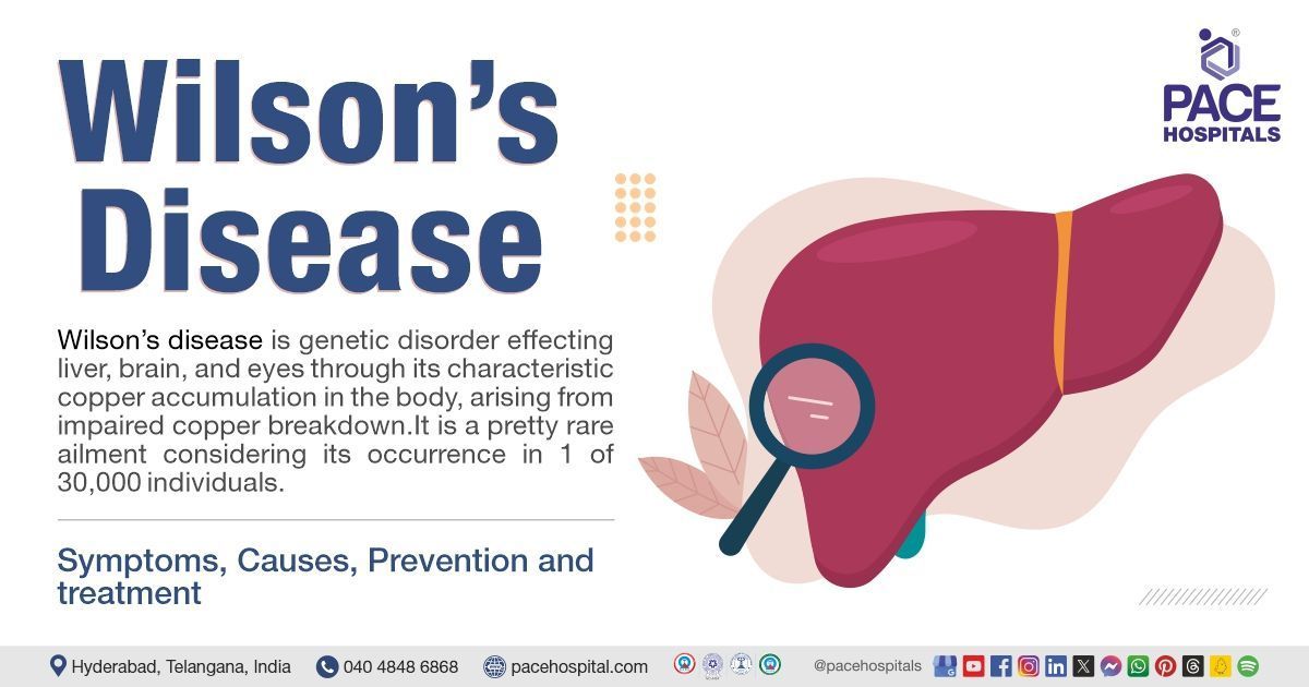 What is Wilson's disease | what causes Wilson's disease | Wilson's disease treatment