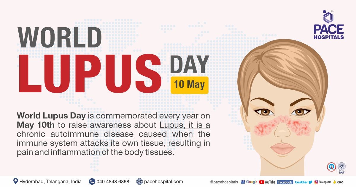 World Lupus Day, 10 May 2023 Theme, Importance & Control