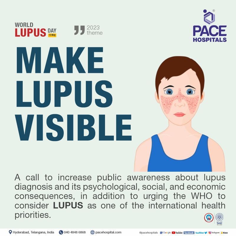 world lupus day 2023 theme