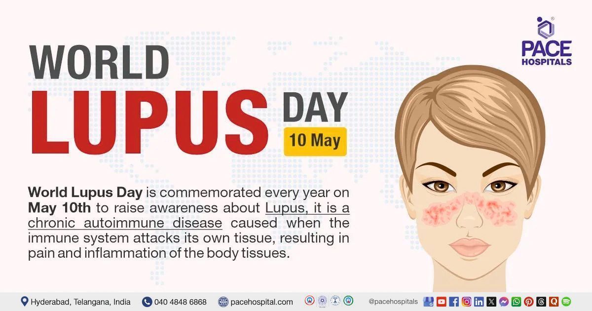 World Lupus Day, 10 May 2025 | Theme, Importance, History & Control