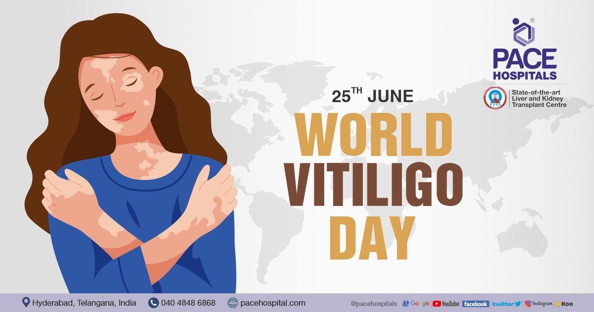 World Vitiligo Day - 25,June 2024, Theme, History, and Importance | What is Vitiligo, Vitiligo means
