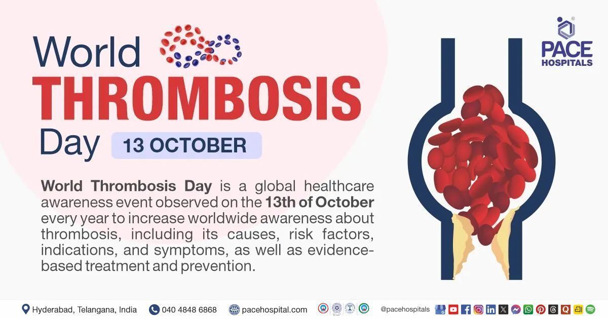 World Thrombosis Day 13 October 2025 – Importance, Theme, History | World Thrombosis Day