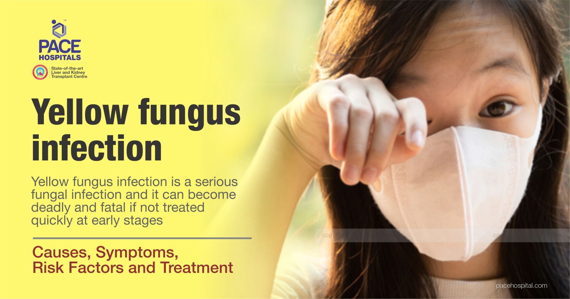 Yellow Fungus Infection: Symptoms, Risks, Causes, Diagnosis, Treatment - in COVID patients