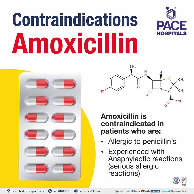 Amoxicillin contraindications | Amoxicillin capsule contraindications | Amoxicillin clavulanate contraindications | Amoxicillin clavulanate potassium contraindications | Amoxicillin drug contraindications