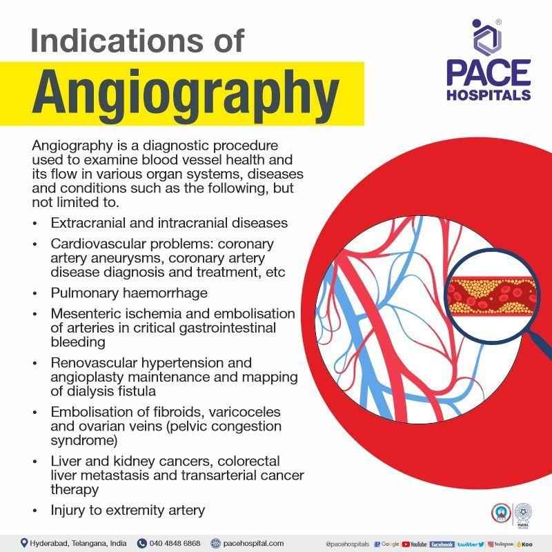 angiogram uses | coronary angiography indications contraindications | angiogram test uses | Coronary Angiography Cost in Hyderabad, India