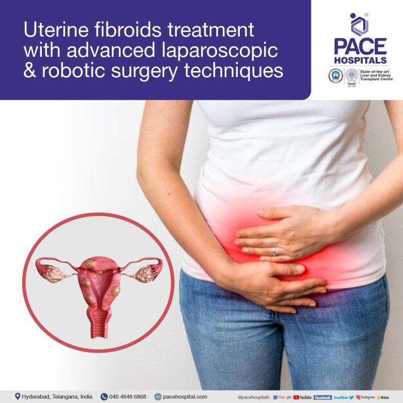 Uterine Fibroid Treatment in Hyderabad | Fibroids Laparoscopic surgery | Robotic Surgery For Uterine Fibroids