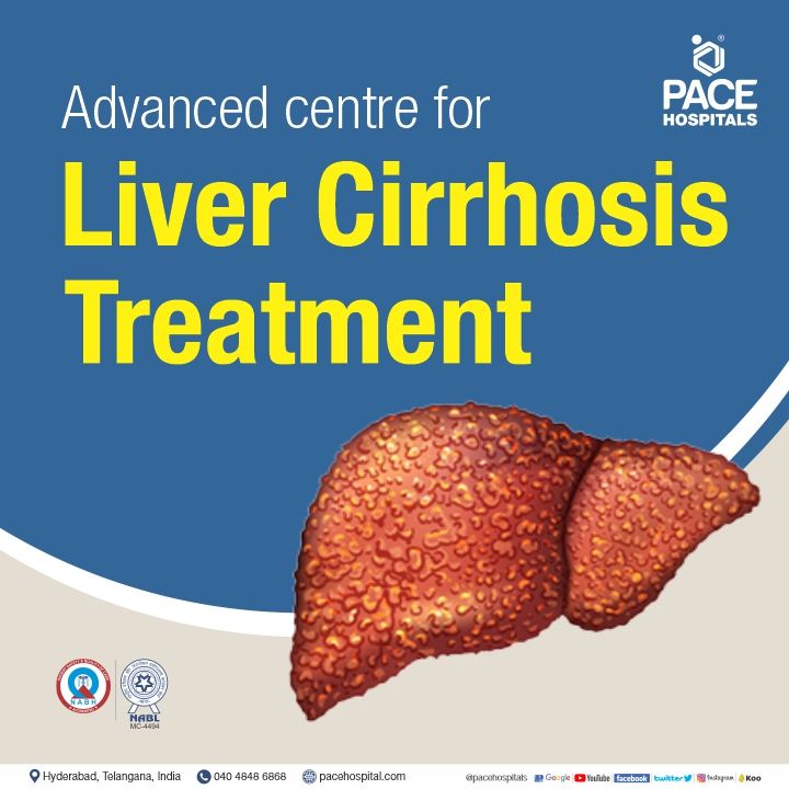 best hospital for liver cirrhosis in Hyderabad | best doctor for liver cirrhosis in India