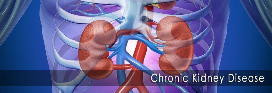 Facts sheet on “Chronic Kidney Disease”