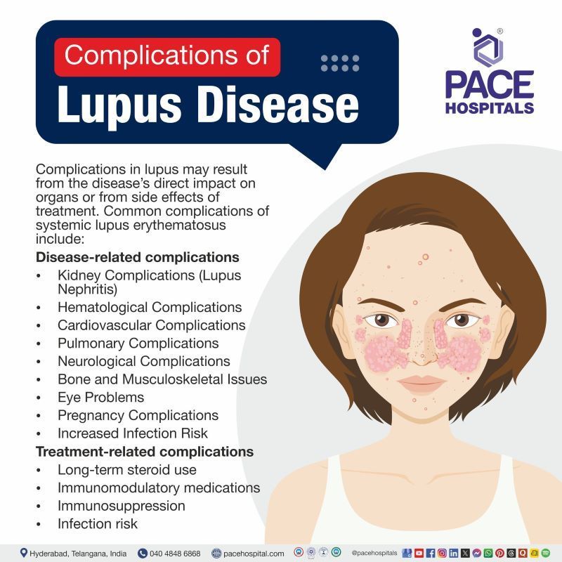 Complications of systemic lupus erythematosus | Lupus complications