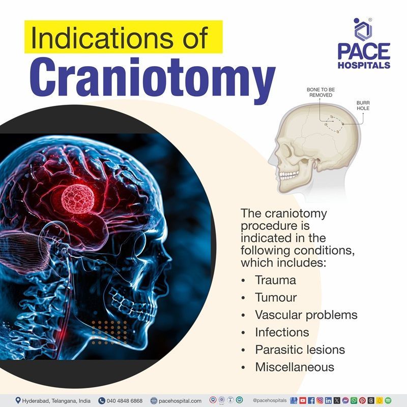 craniotomy indications | indications of craniotomy procedure | indications craniotomy surgery