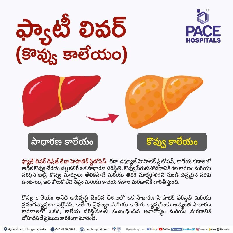 fatty liver meaning in telugu | grade 1 fatty liver means in telugu | fatty liver in telugu | fatty liver symptoms telugu