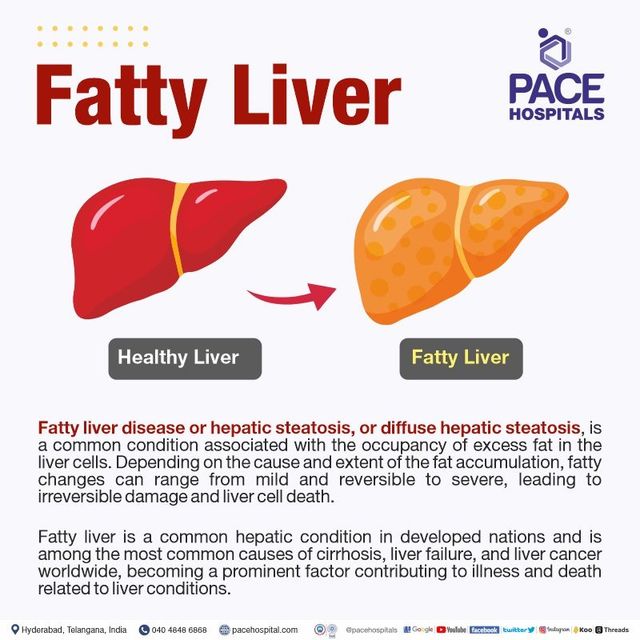 enlarged liver hepatitis