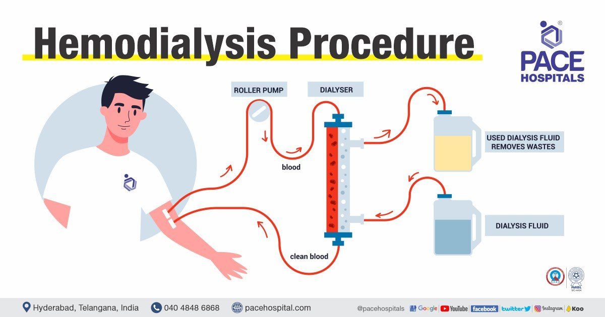 Hemodialysis procedure in Hyderabad | Haemodialysis procedure in India | Cost of Hemodialysis | Price of Haemodialysis