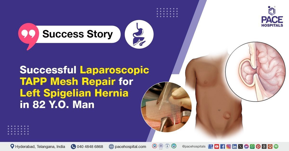 Case study of a patient with left Spigelian hernia successfully treated at PACE Hospitals, Hyderabad