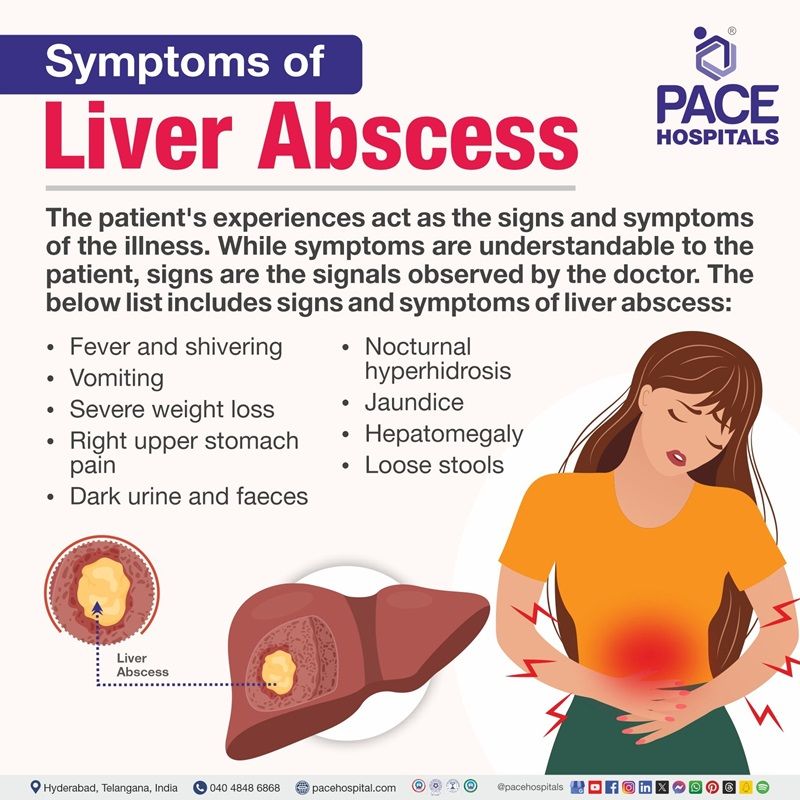 liver abscess symptoms | symptoms of liver abscess | amoebic liver abscess symptoms | liver abscess signs and symptoms | Visual depicting the signs and symptoms of liver abscess
