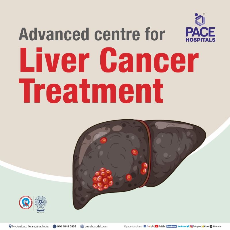 Best Hospital for liver cancer treatment in hyderabad | top liver cancer hospital in hyderabad | famous liver cancer doctors in hyderabad | liver cancer specialist in hyderabad