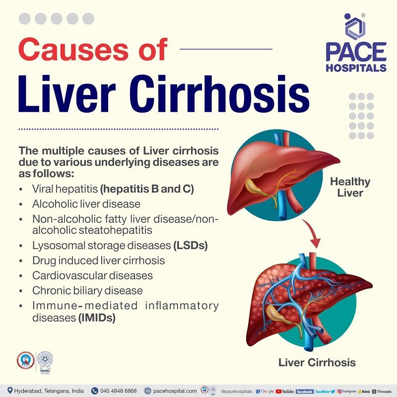 liver cirrhosis causes in India | etiology of liver cirrhosis | liver cirrhosis reason | what causes cirrhosis of the liver
